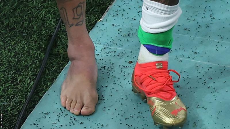 Neymar tirou o calçado para mostrar um tornozelo direito muito inchado depois de ser substituído perto do final da vitória do Brasil sobre a Sérvia