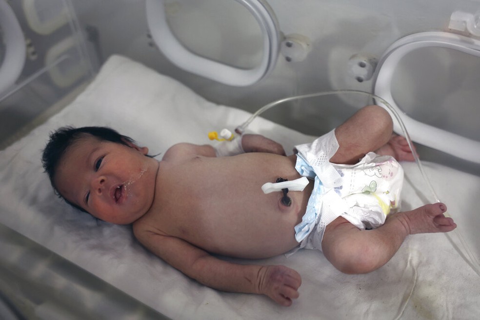 Bebê órfã Aya recebe tratamento em hospital na Síria e recebeu várias propostas de adoção — Foto: AP Photo/Ghaith Alsayed